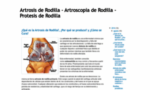 Artrosisderodilla.blogspot.com thumbnail