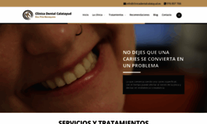 Clinicadentalcalatayud.es thumbnail