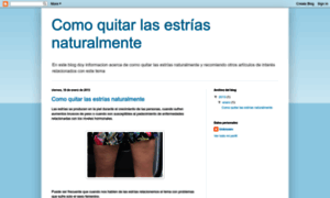 Como-eliminar-las-estrias-natural.blogspot.com thumbnail