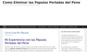 Comoeliminarpapulasperladas.com thumbnail