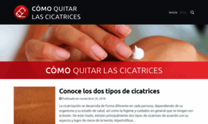 Comoquitarlascicatrices.com thumbnail