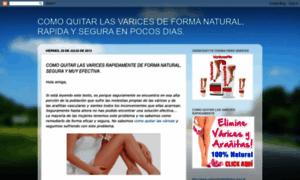 Comoquitarlasvaricesya.blogspot.mx thumbnail