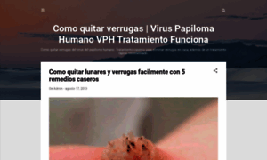 Comoquitarverrugas.blogspot.mx thumbnail