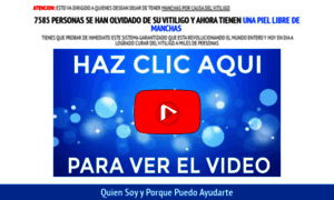 Cuerposinvitiligo.com thumbnail