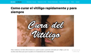 Curarelvitiligo.com thumbnail