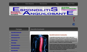 Espondilitis.eu thumbnail