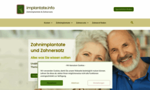 Implantate.info thumbnail