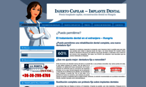Implante-dental.biz thumbnail