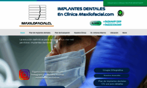 Implantes.cl thumbnail
