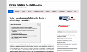 Laportadental-implante.es thumbnail