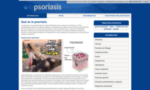 Lapsoriasis.info thumbnail