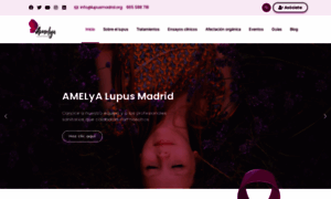 Lupusmadrid.com thumbnail