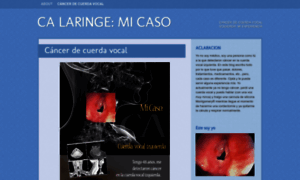 Micasocalaringe.wordpress.com thumbnail