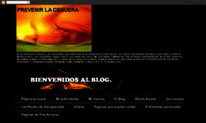 Prevenirlaceguera.blogspot.com thumbnail