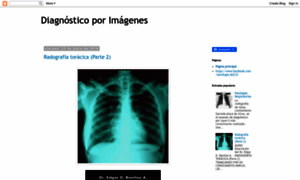 Radiografia99.blogspot.cl thumbnail