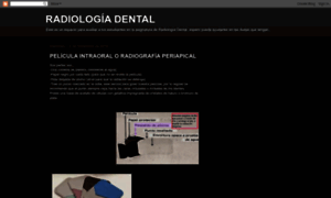 Radiologiadentall.blogspot.com thumbnail