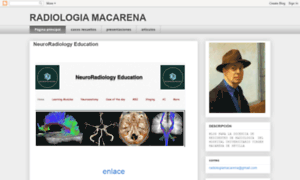 Radiologiamacarena.blogspot.com thumbnail