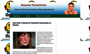 Rosaceatratamiento60dias.blogspot.mx thumbnail