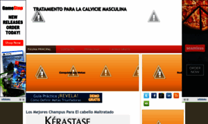 Tratamientoparalacalvicie.blogspot.com.es thumbnail