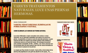 Varicestratamientosnaturales.blogspot.mx thumbnail