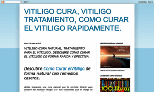 Vitiligocuranatural.blogspot.mx thumbnail